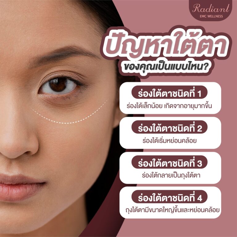 ปัญหาใต้ตา