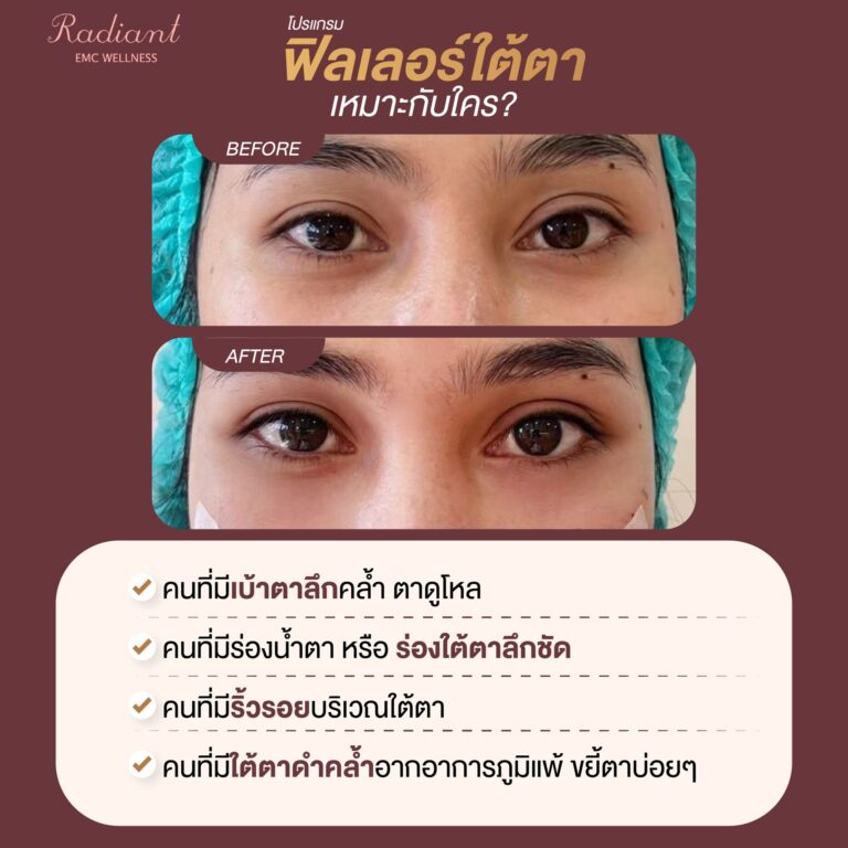 โปรแกรมฟิลเลอร์