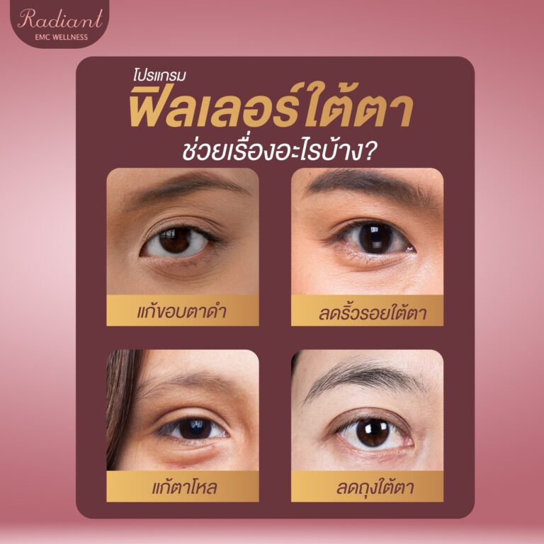 ฟิลเลอร์ใต้ตา