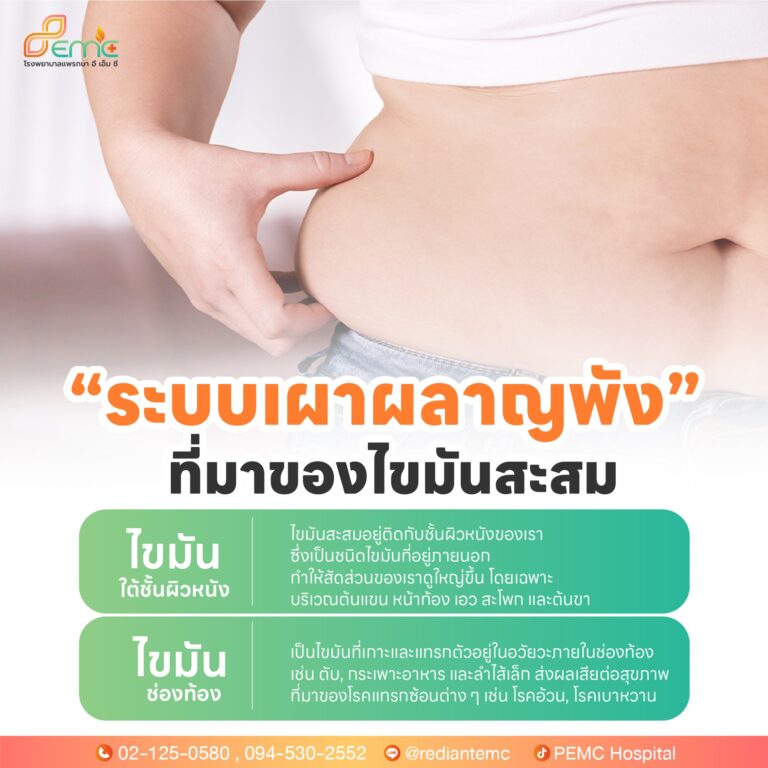 ไขมันสะสม