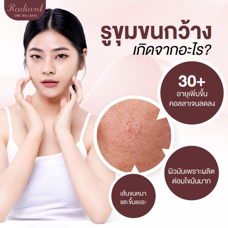 รูขุมขนกว้าง