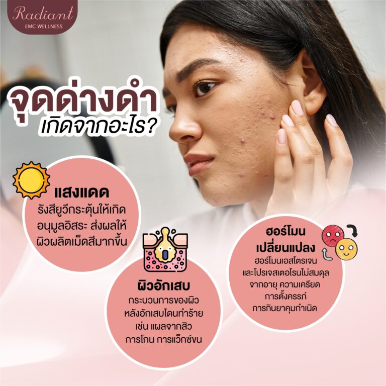 จุดด่างดำเกิดจากอะไร