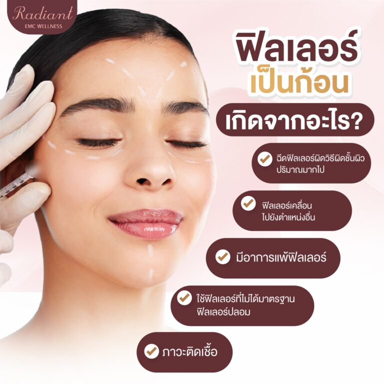 ฟิลเลอร์เป็นก้อน