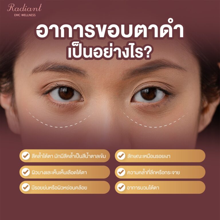 ขอบตาดำ