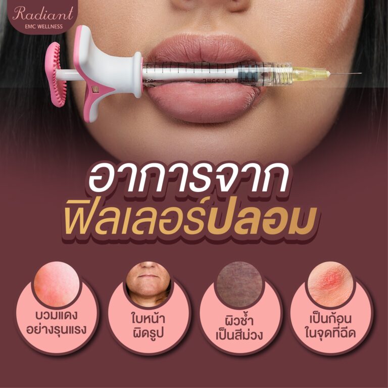 ฟิลเลอร์ปลอม