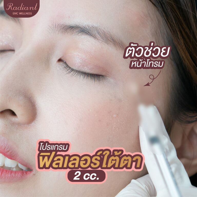 ฟิลเลอร์ใต้ตา