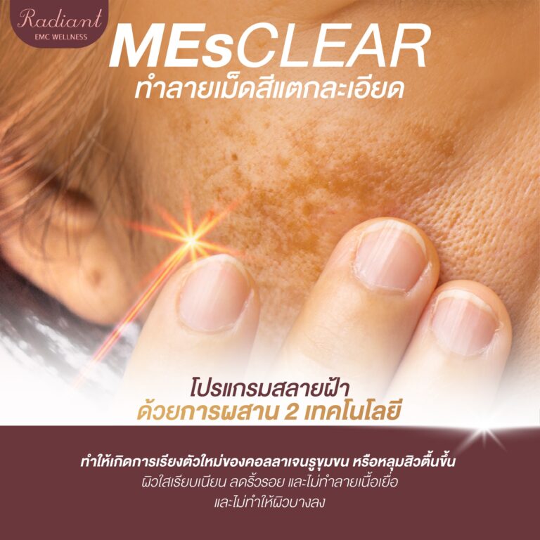 จุดด่างดำ