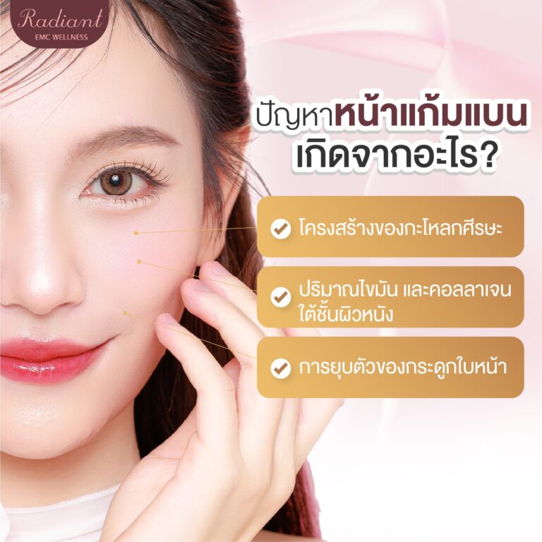 แก้มแบน