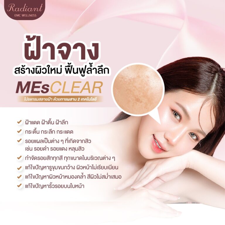 เปลี่ยนผิวเสีย