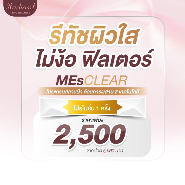 จุดด่างดำ