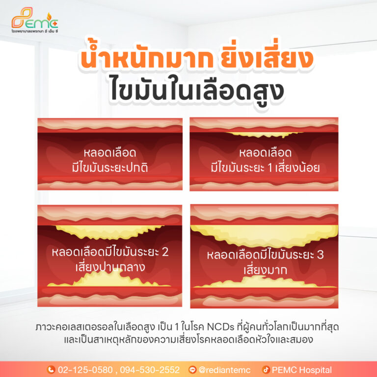 ไขมันในเลือด