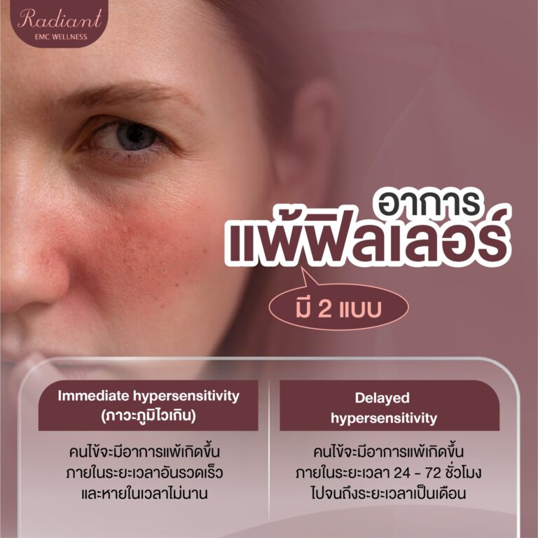 ฟิลเลอร์