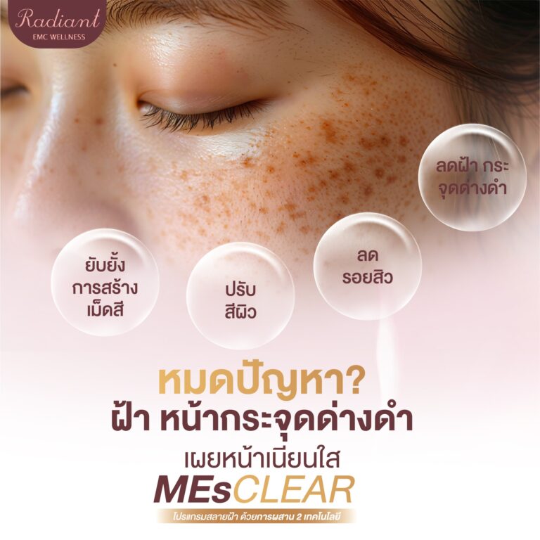 จุดด่างดำ