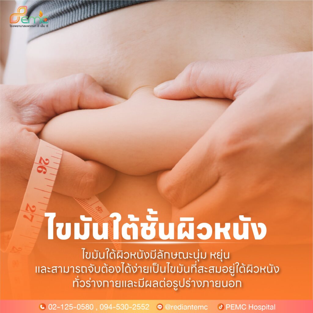 ไขมันหน้าท้อง