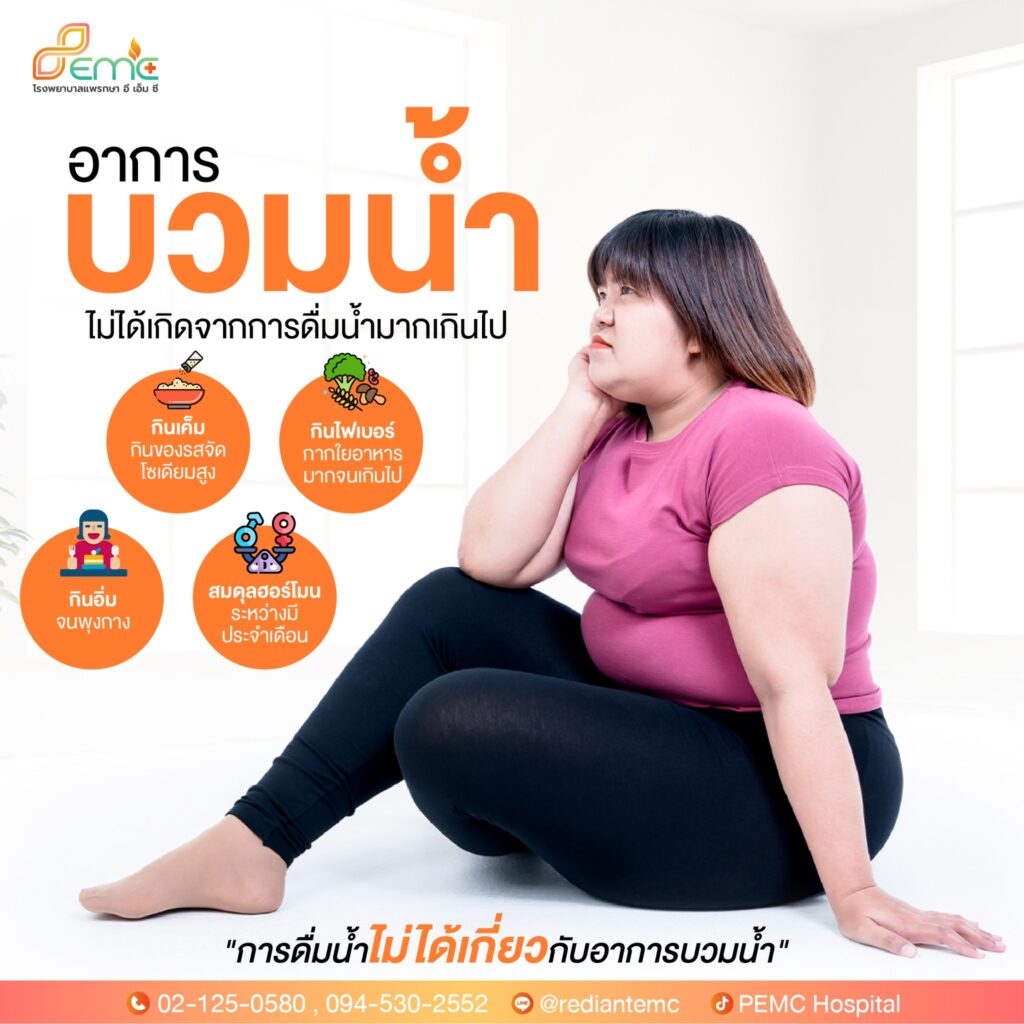 อาการบวมน้ำ