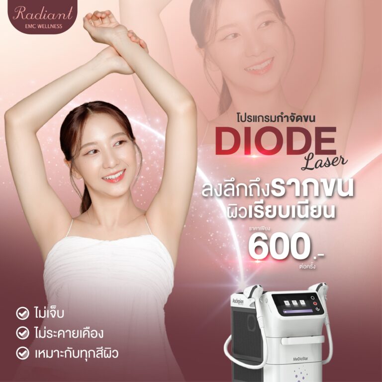DIODE Laser