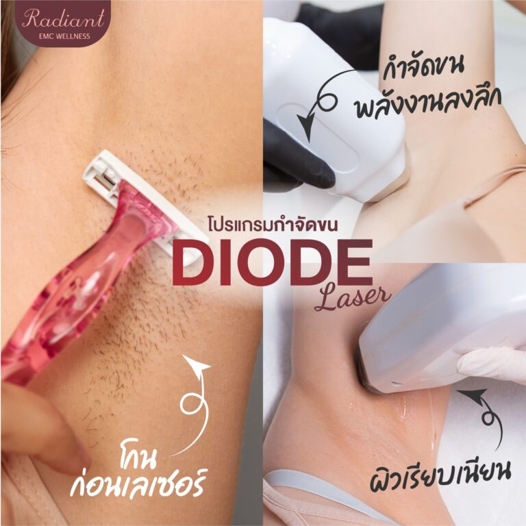 โปรแกรมกำจัดขน