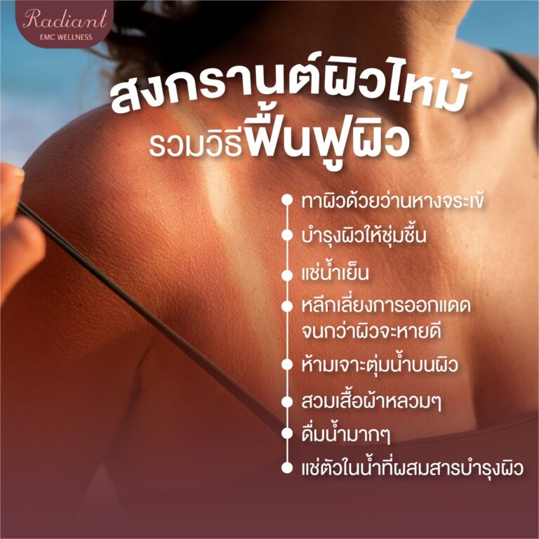 ผิวไหม้