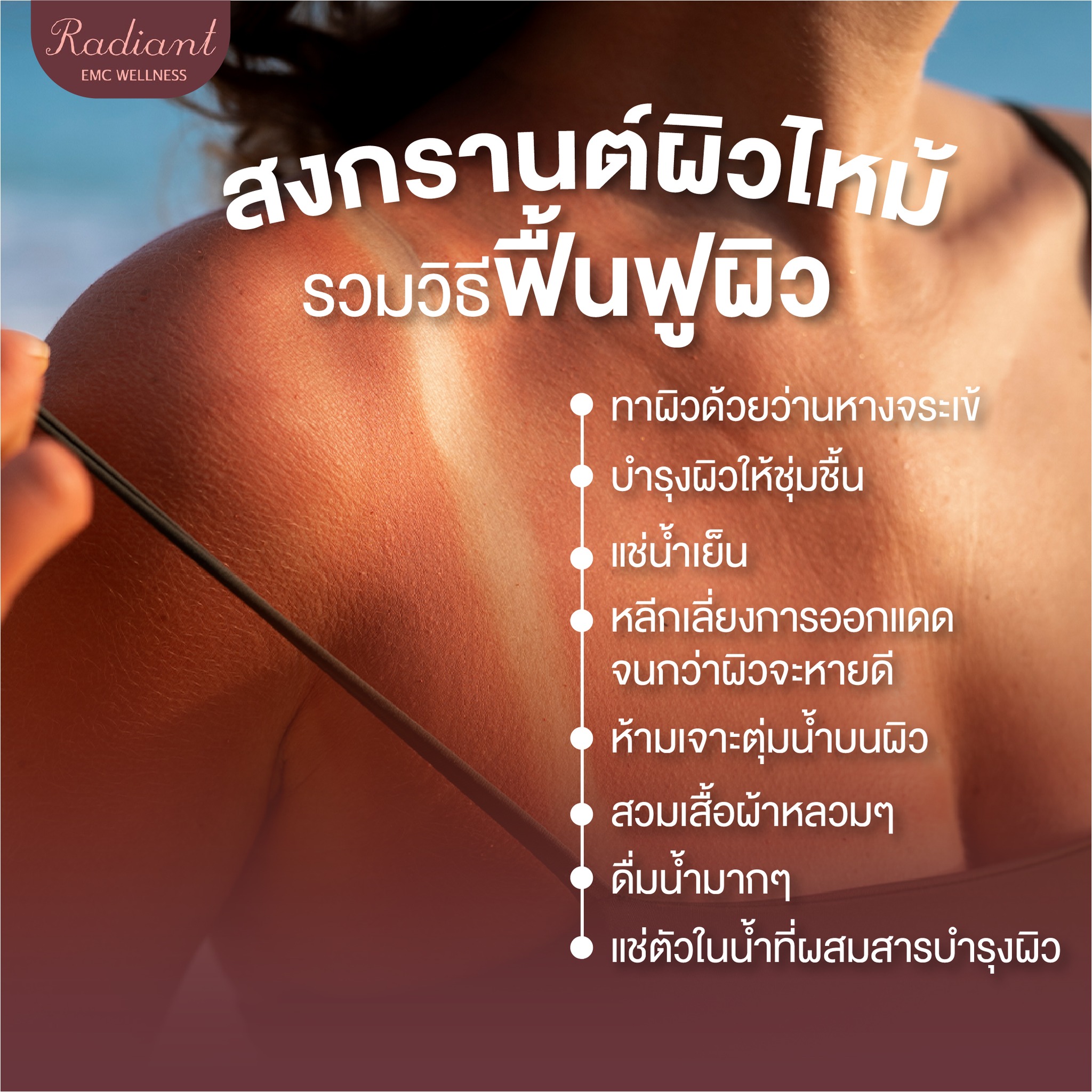 ผิวไหม้