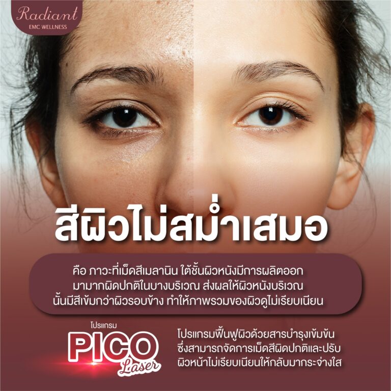 สีผิวไม่สม่ำเสมอ