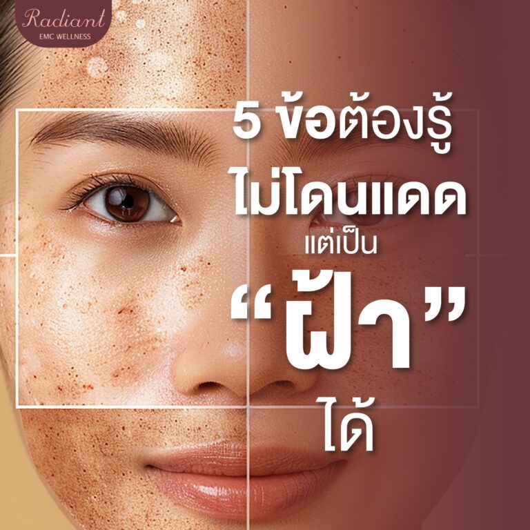 เป็นฝ้า