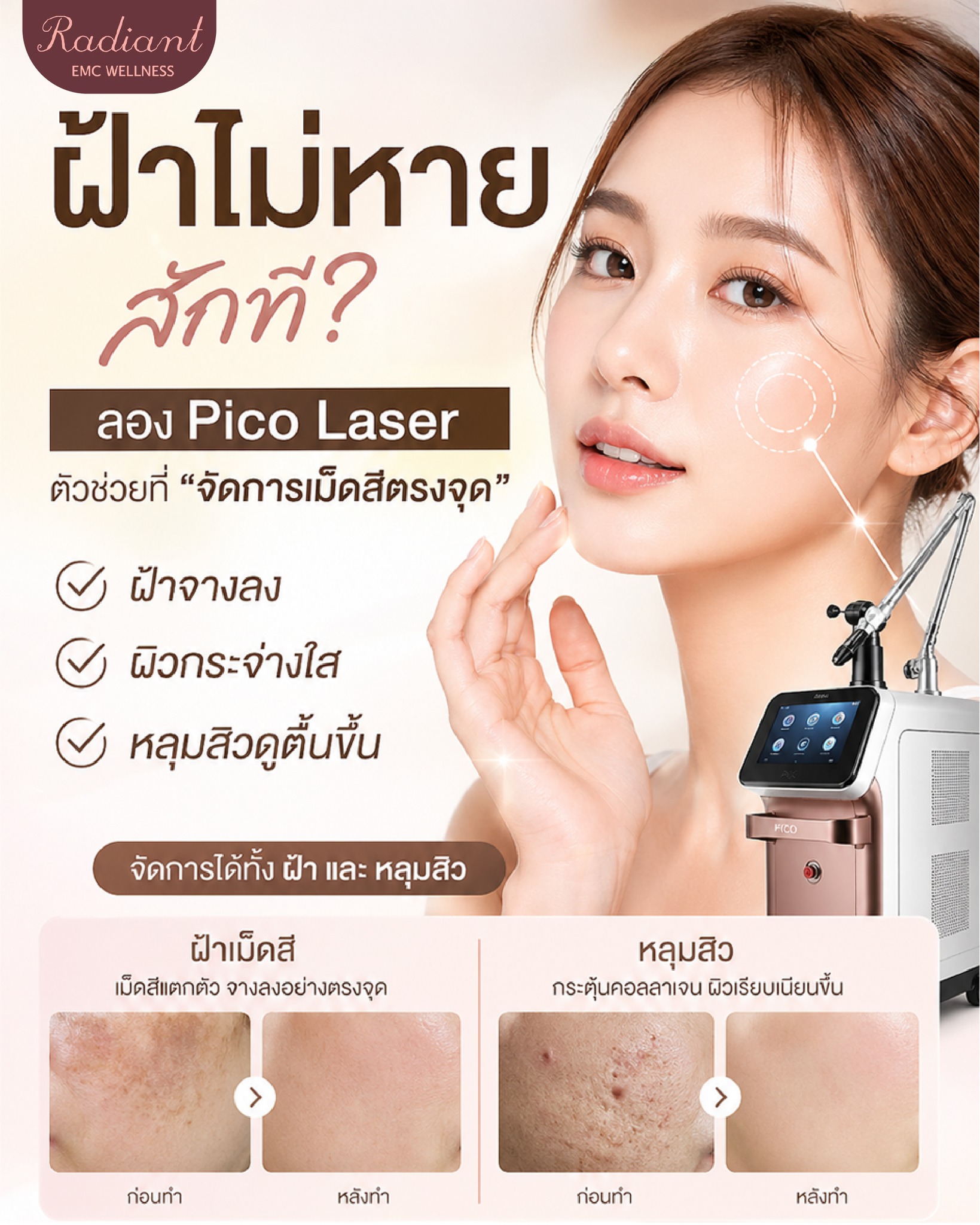 ฝ้าไม่หาย