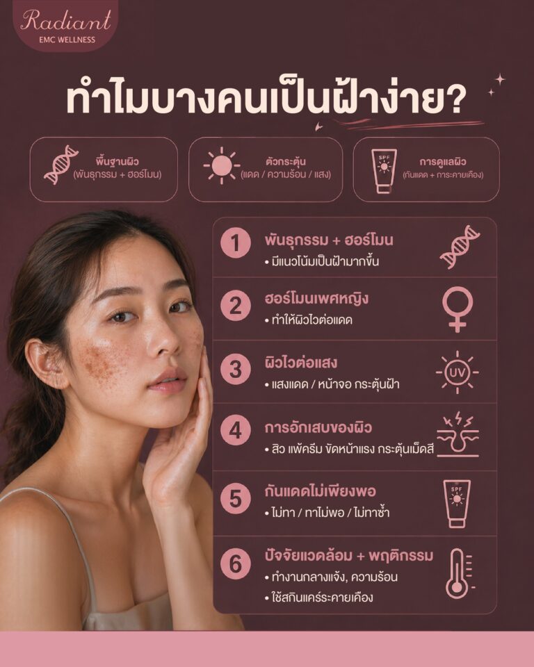 ฝ้า