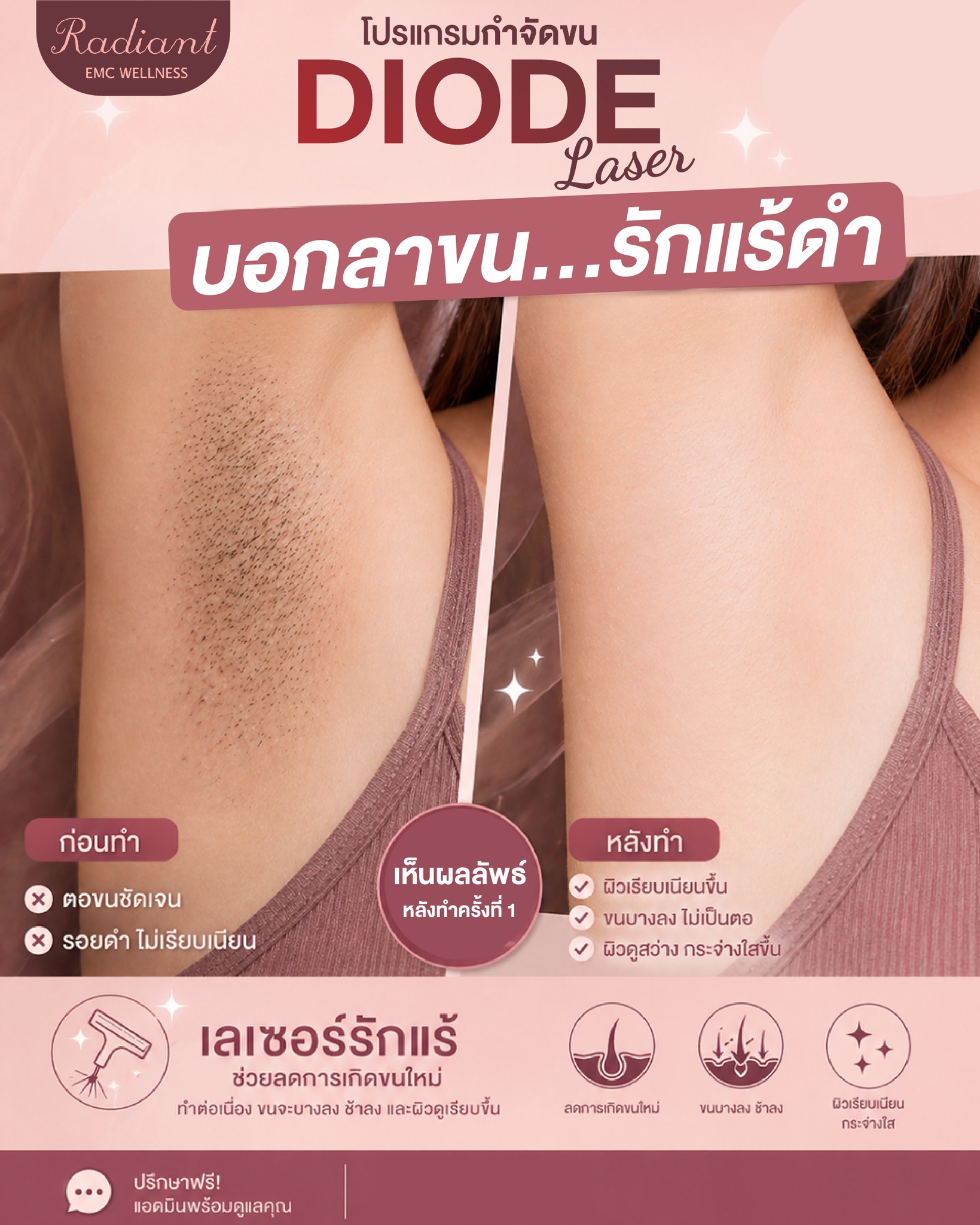 รักแร้ดำ