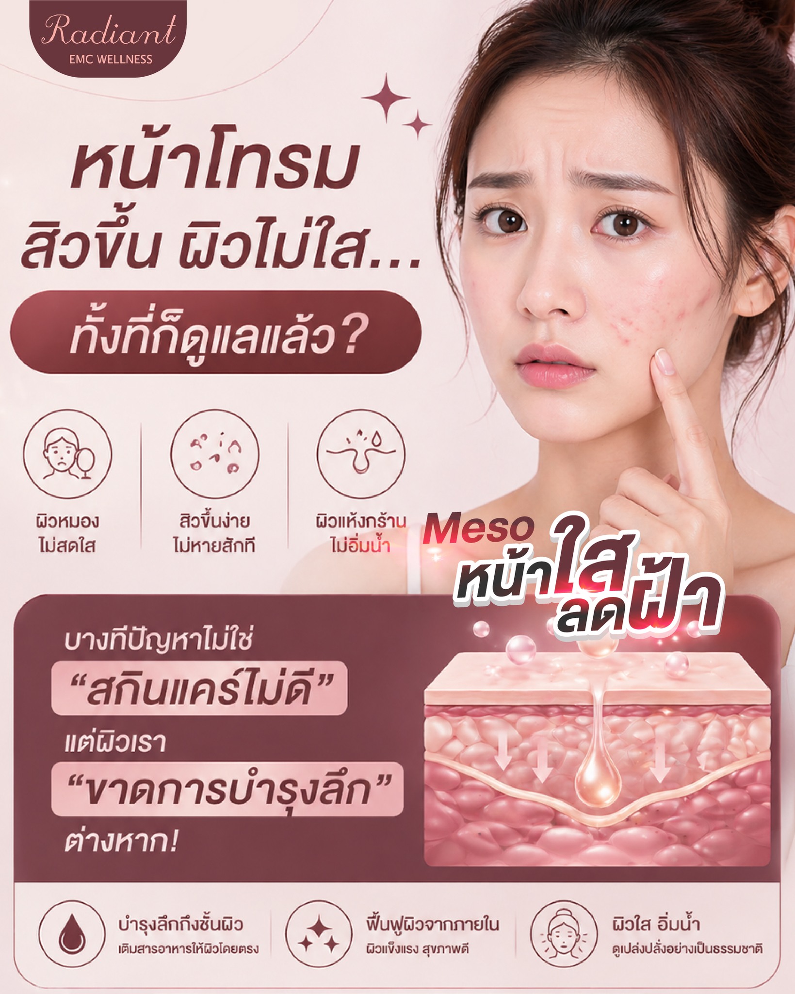 หน้าโทรม