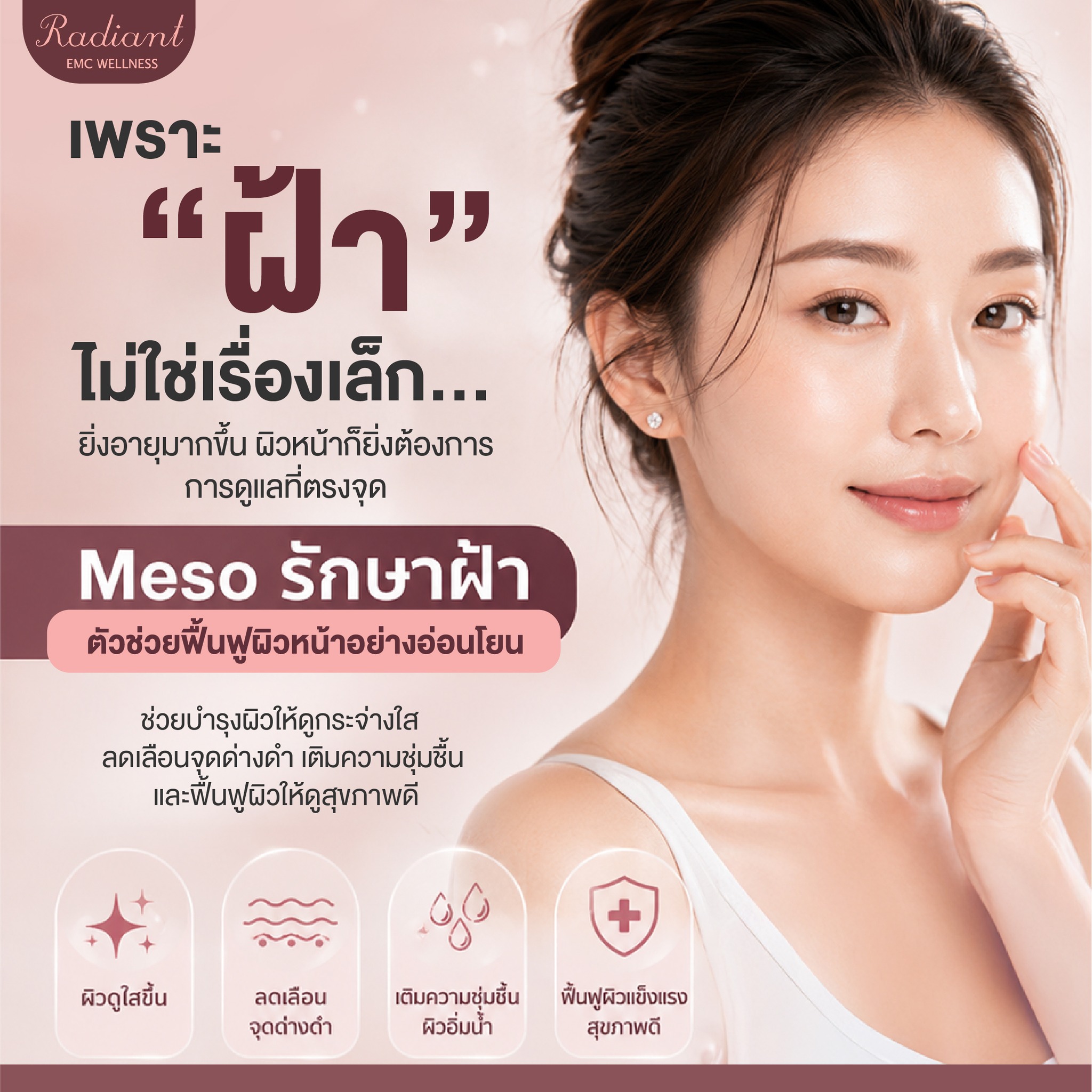 ฝ้า