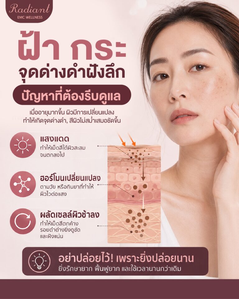 ฝ้า กระ จุดด่างดำ