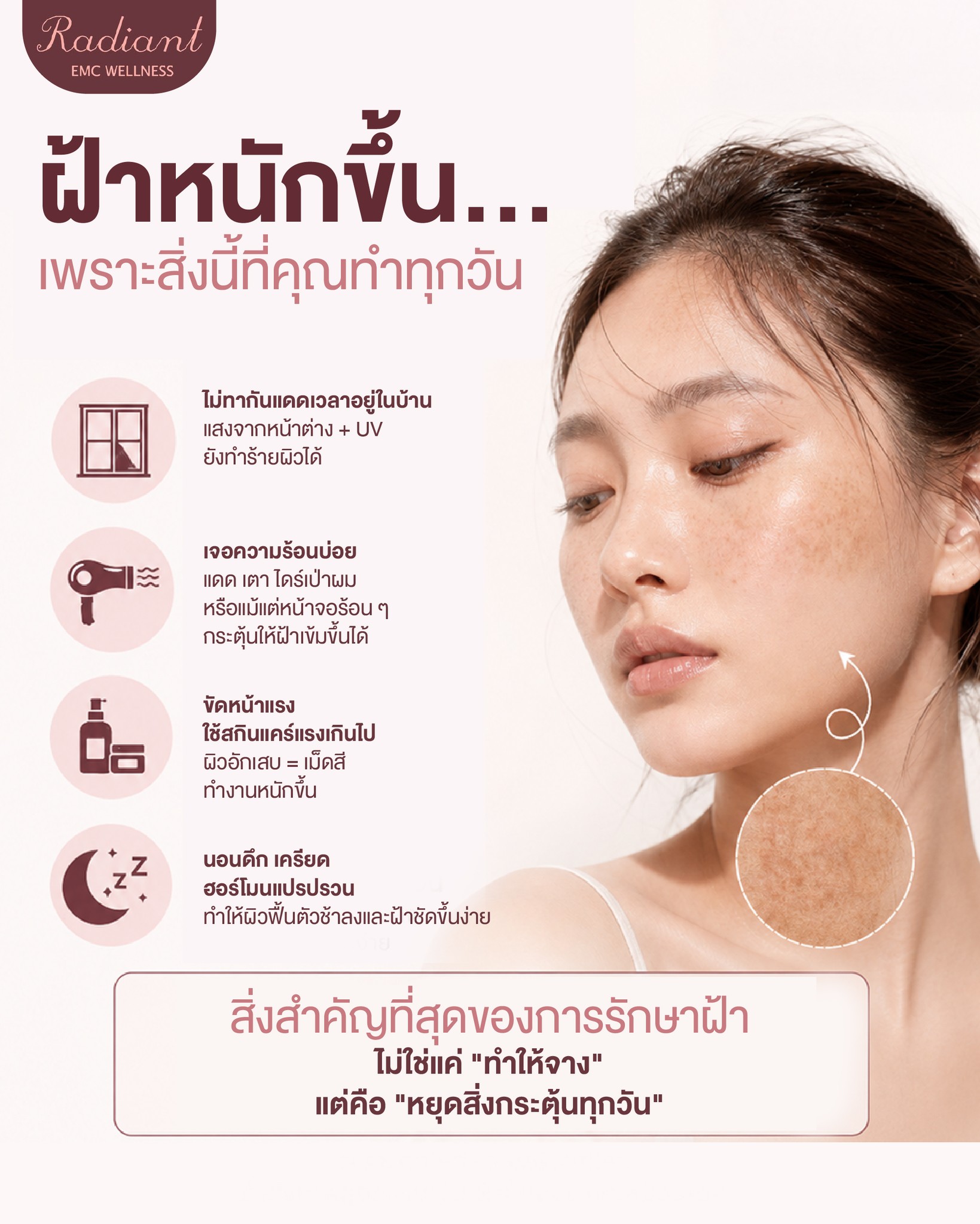 ฝ้า