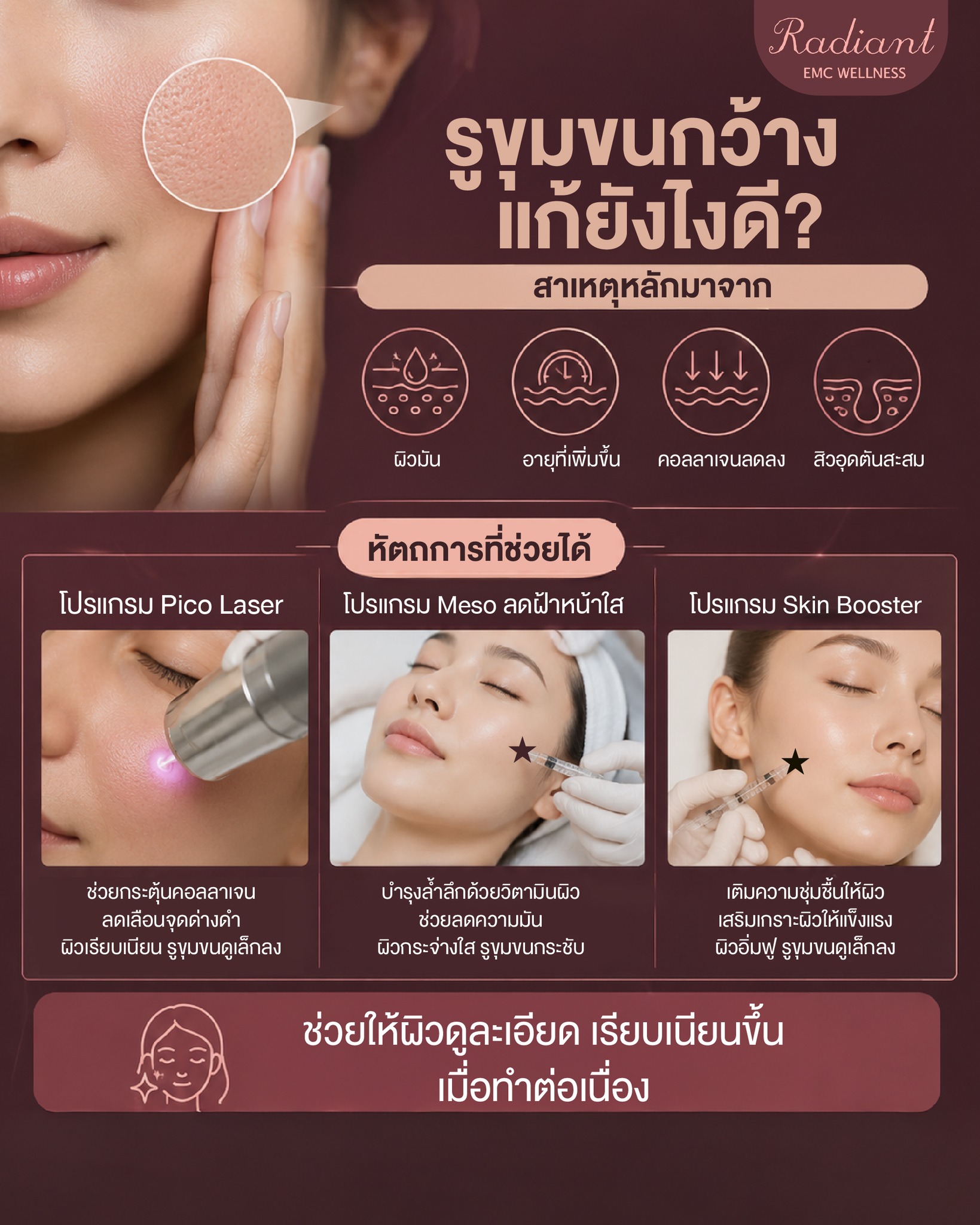 รูขุมขนกว้าง