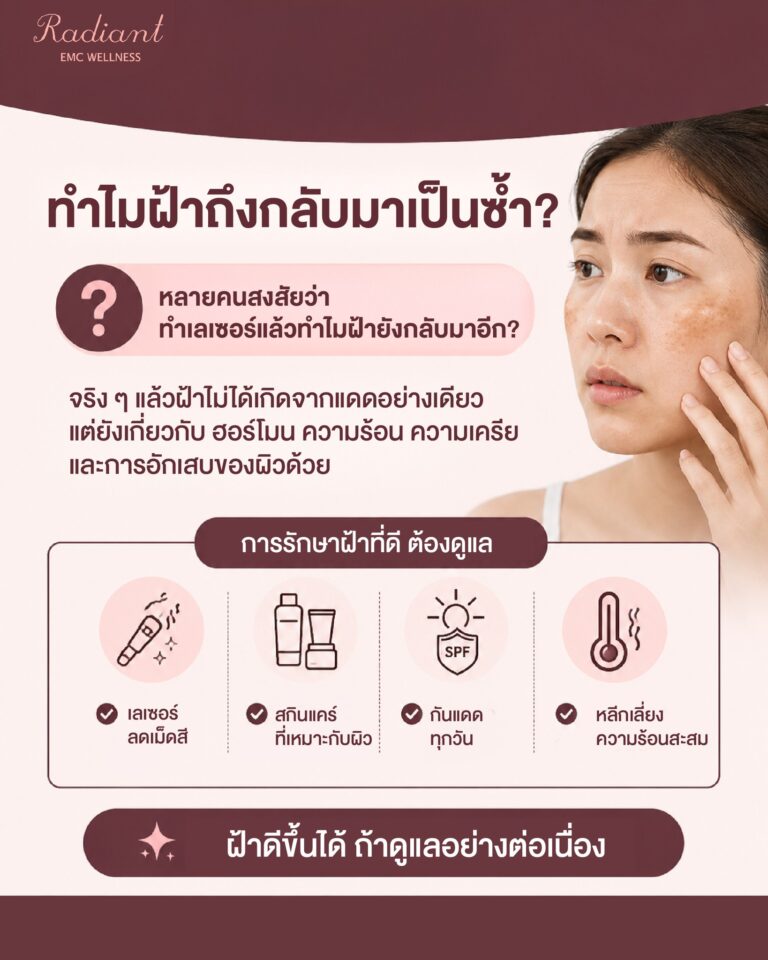 ฝ้า
