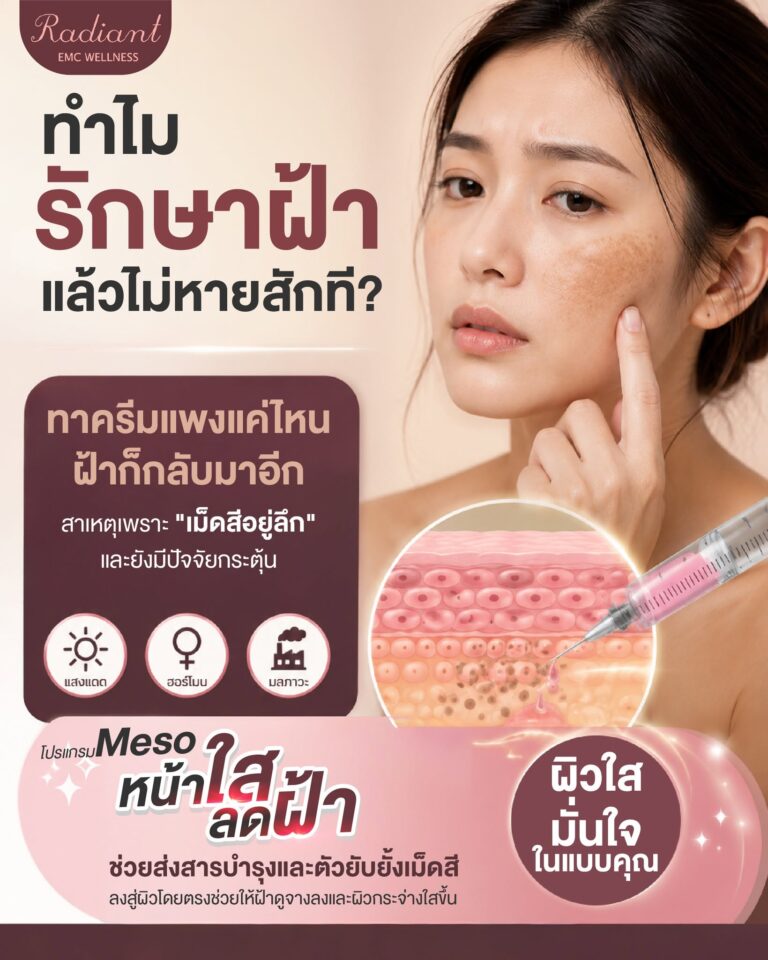 รักษาฝ้า