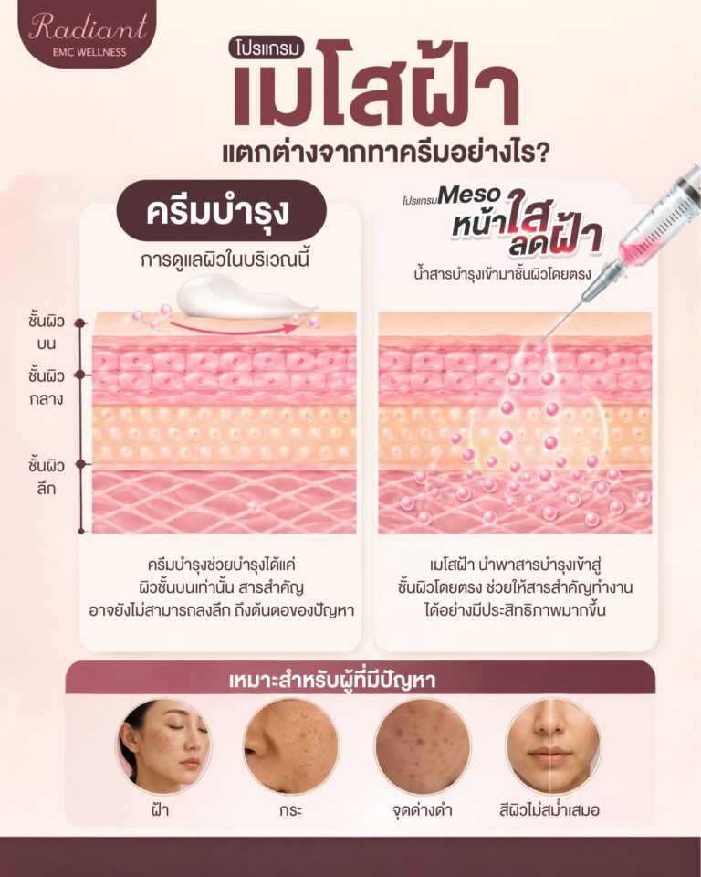Meso ฝ้า