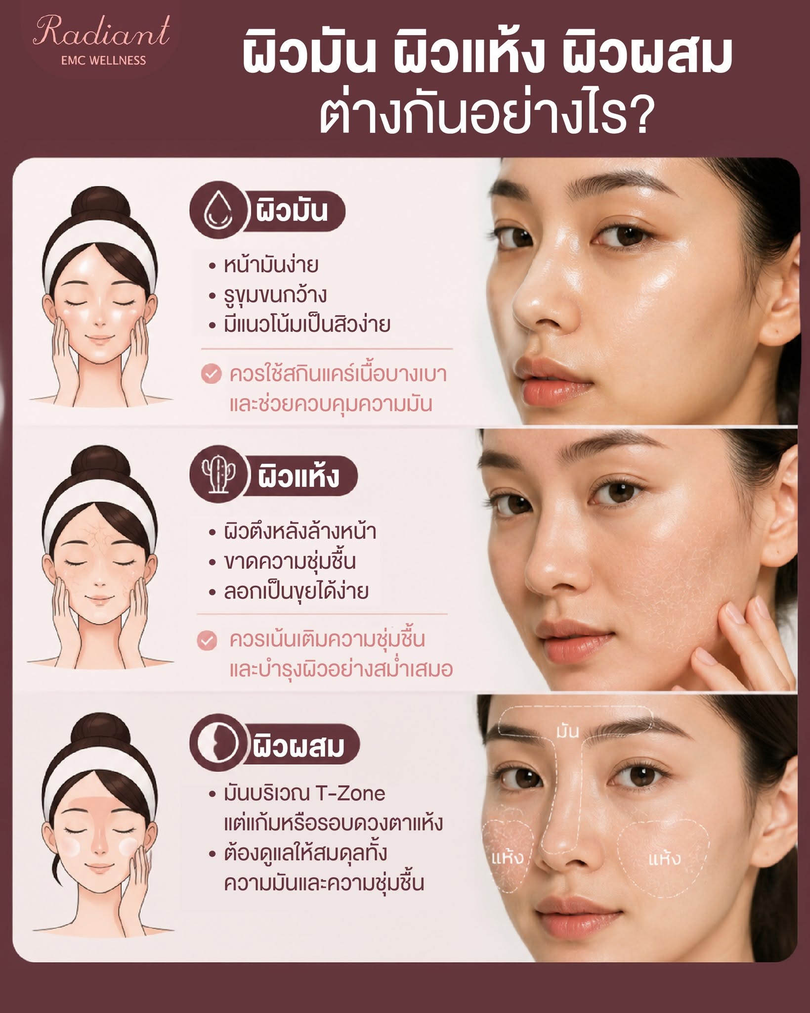 ผิวผสม