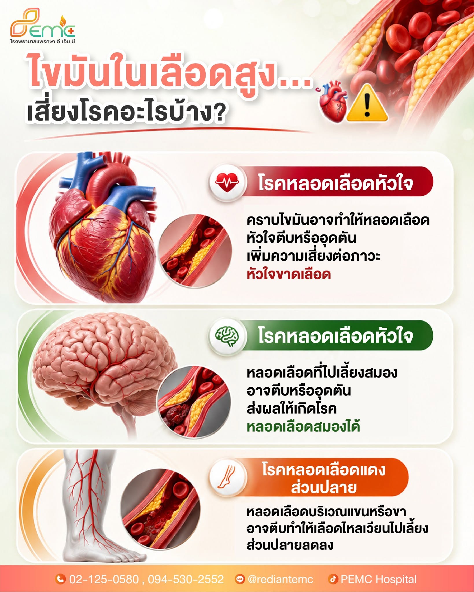 ไขมันในเลือดสูง