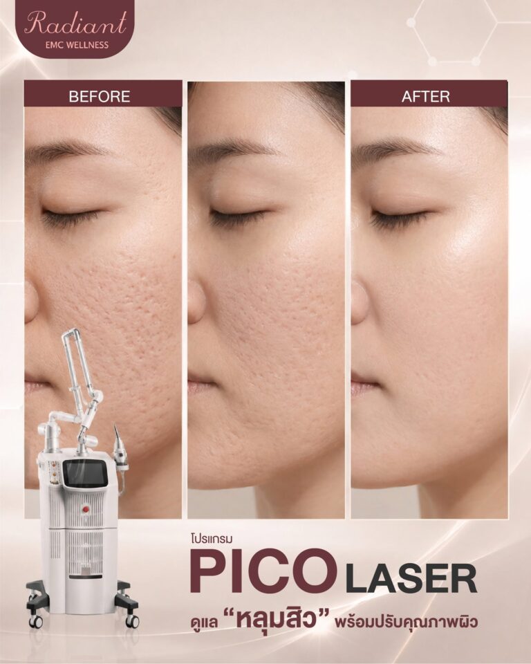 PICO LASER