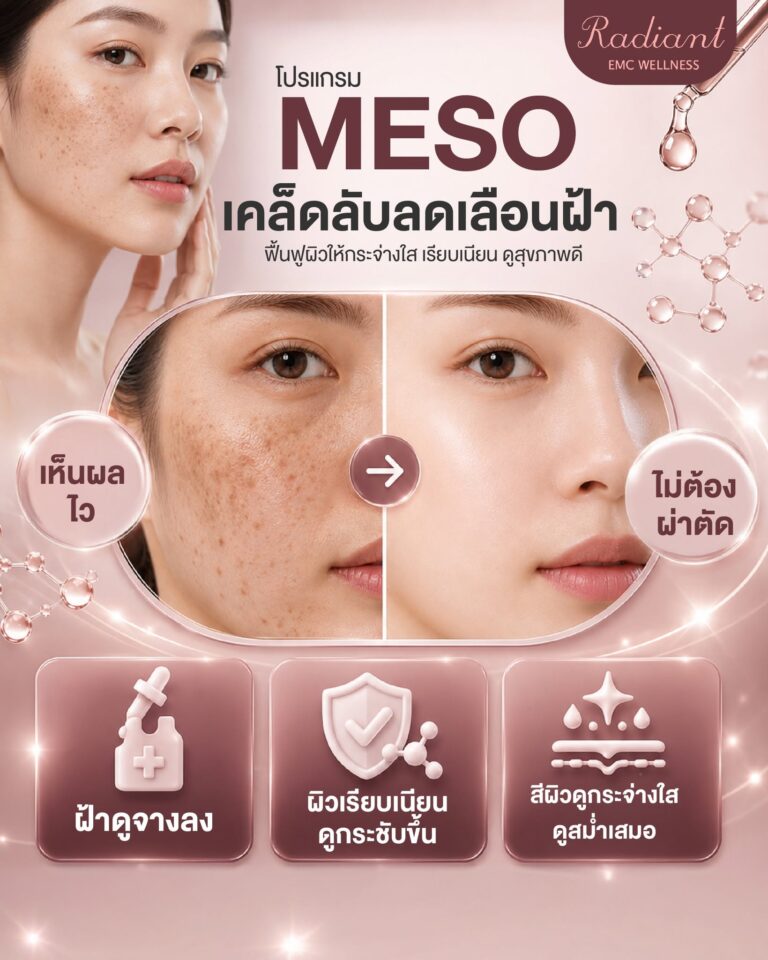 MESO หน้าใส