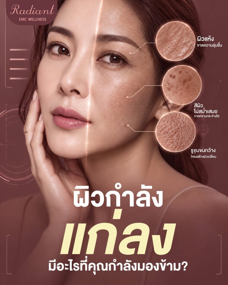 ผิวกำลังแก่ลง