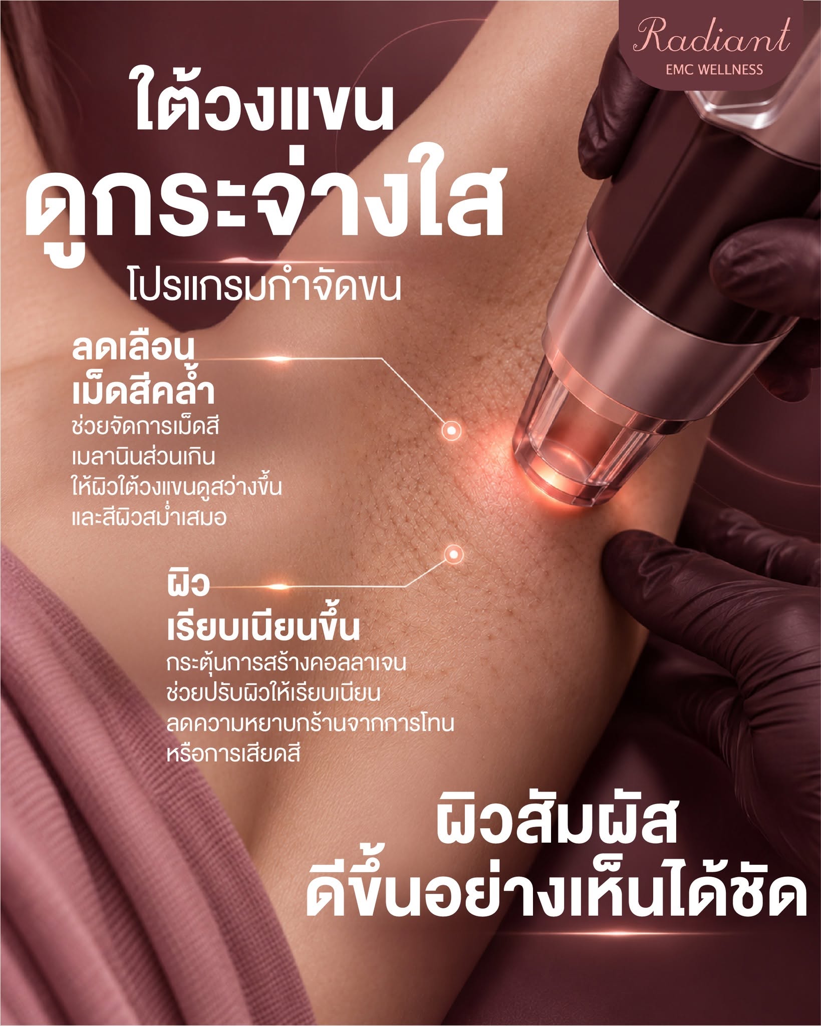 ใต้วงแขน