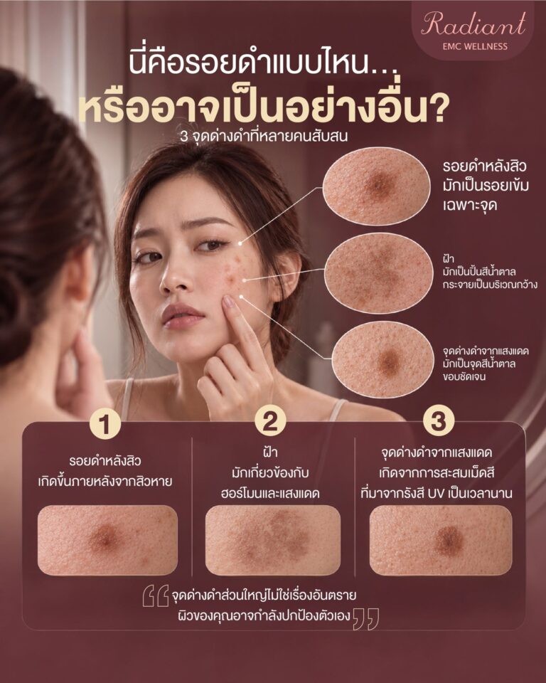 จุดด่างดำ