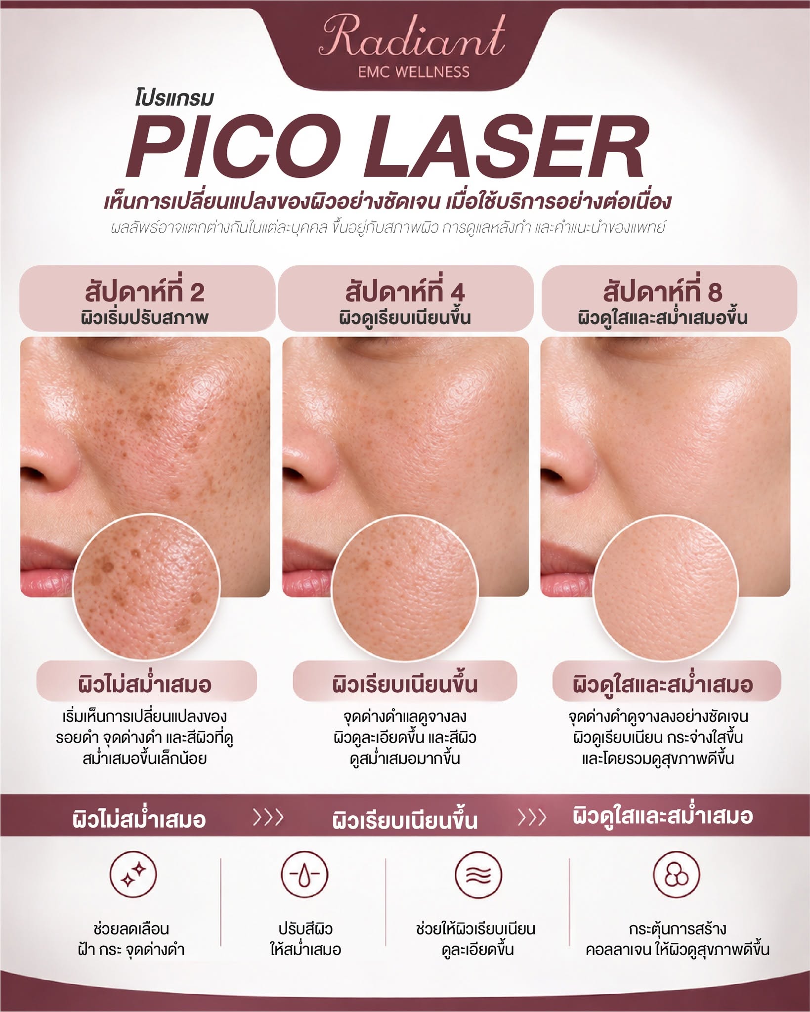 PICO LASER