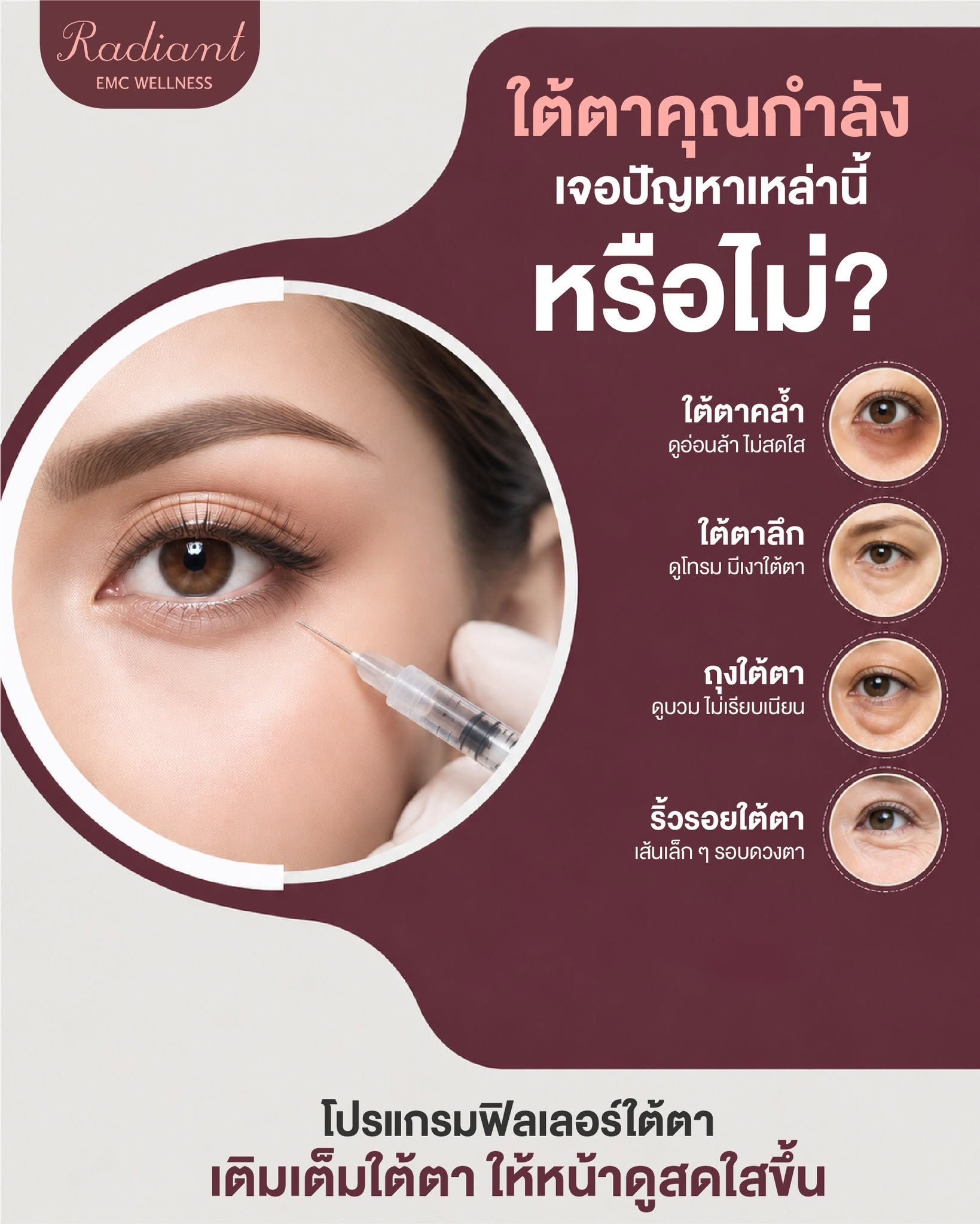 ใต้ตา
