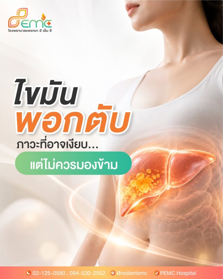 ไขมันพอกตับ