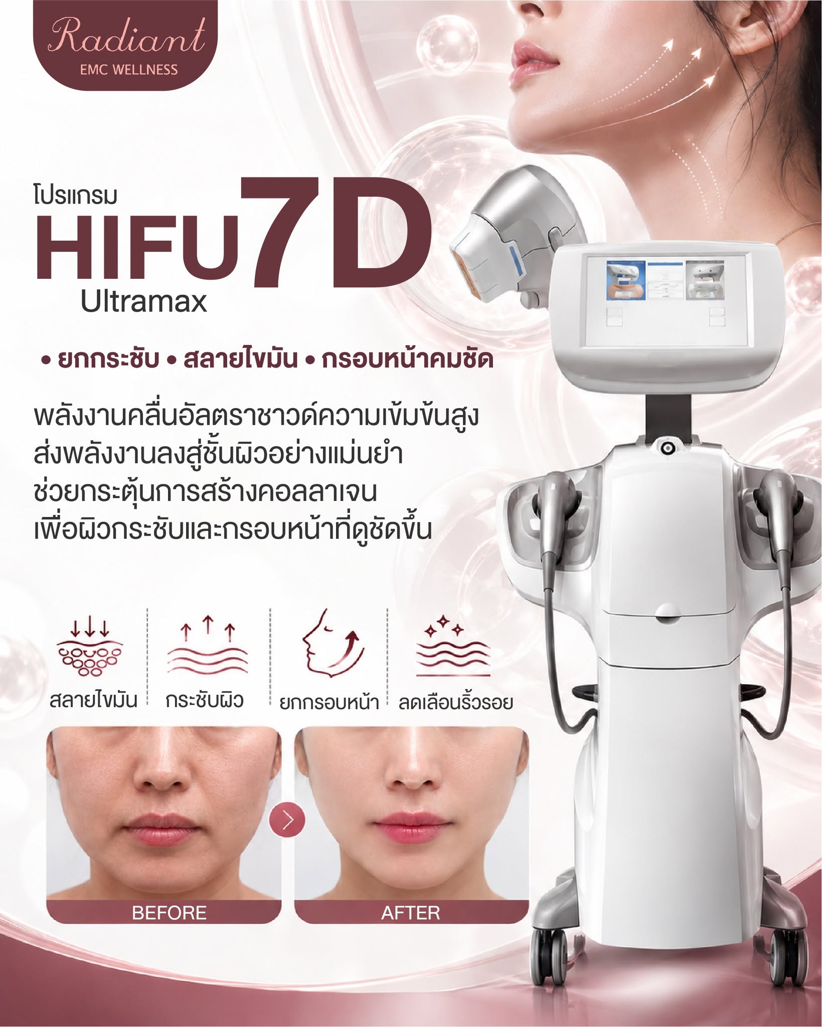 สลายไขมันส่วนเกิน