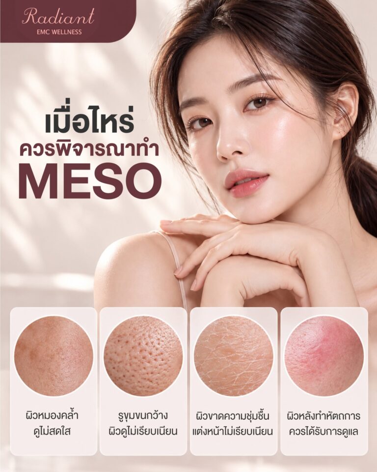ทำ MESO