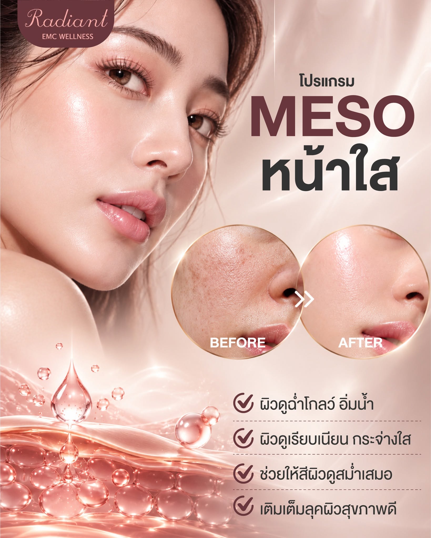 หน้าโทรม