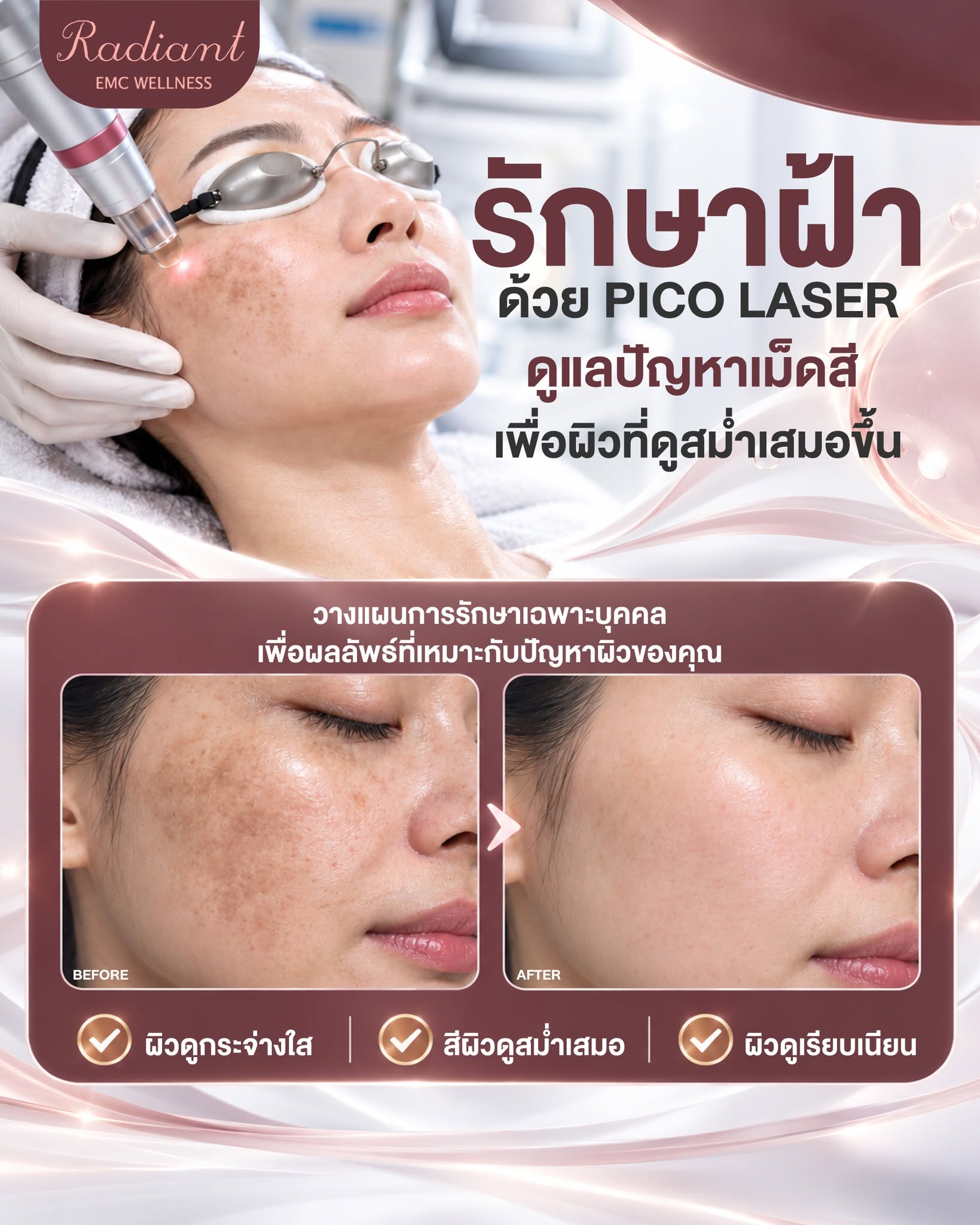 PICO LASER